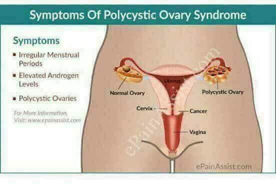 DEAR GIRLS, PLEASE TAKE TIME TO READ. THANK YOU!

Luxxe White Enhanced Glutathione is advisable for (PCOS)

According to WebMD, Polycystic Ovarian Syndrome  (PCOS) is a problem in which a woman’s hormones are out of balance. It can cause problems with your periods