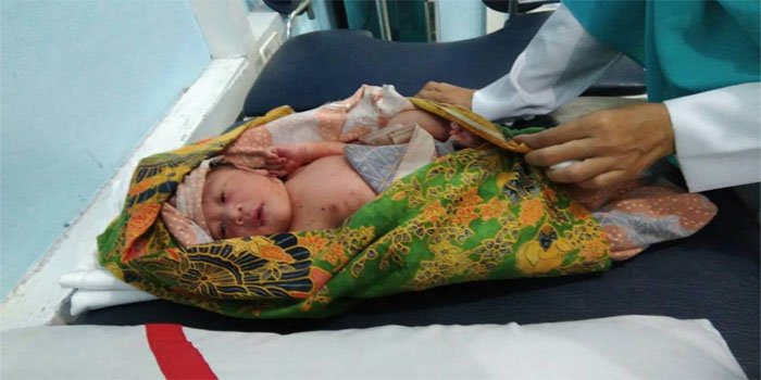 tribunpontianak's tweet photo. DITEMUKAN BAYI LAKI-LAKI DI JALAN AYANI 2 KUBU RAYA
======> https://t.co/0URrLEizDT

Bayi diperkirakan usianya 8 jam setelah dilahirkan. Kondisinya berlumuran darah dengan tali pusar yang masih utuh. https://t.co/KYht1Djf5P