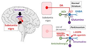 bioanalytic's tweet image. #Dopamine (DA) #toxicity in pathogenesis and therapy of Parkinson&apos;s disease (PD). @ alliedacademies.org/articles/dopam…