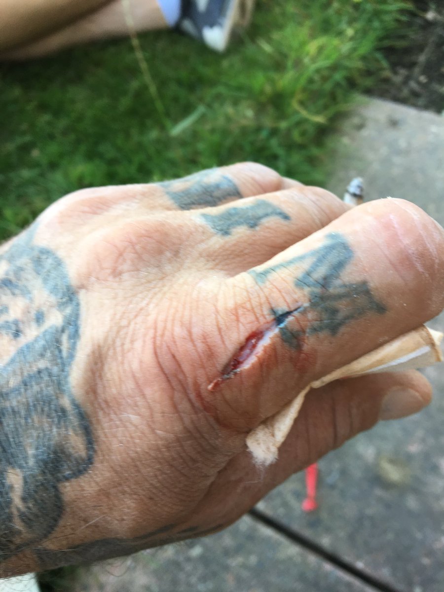 StuartKray's tweet image. Don’t take the guard off a 4” angle grinder is the lesson there....