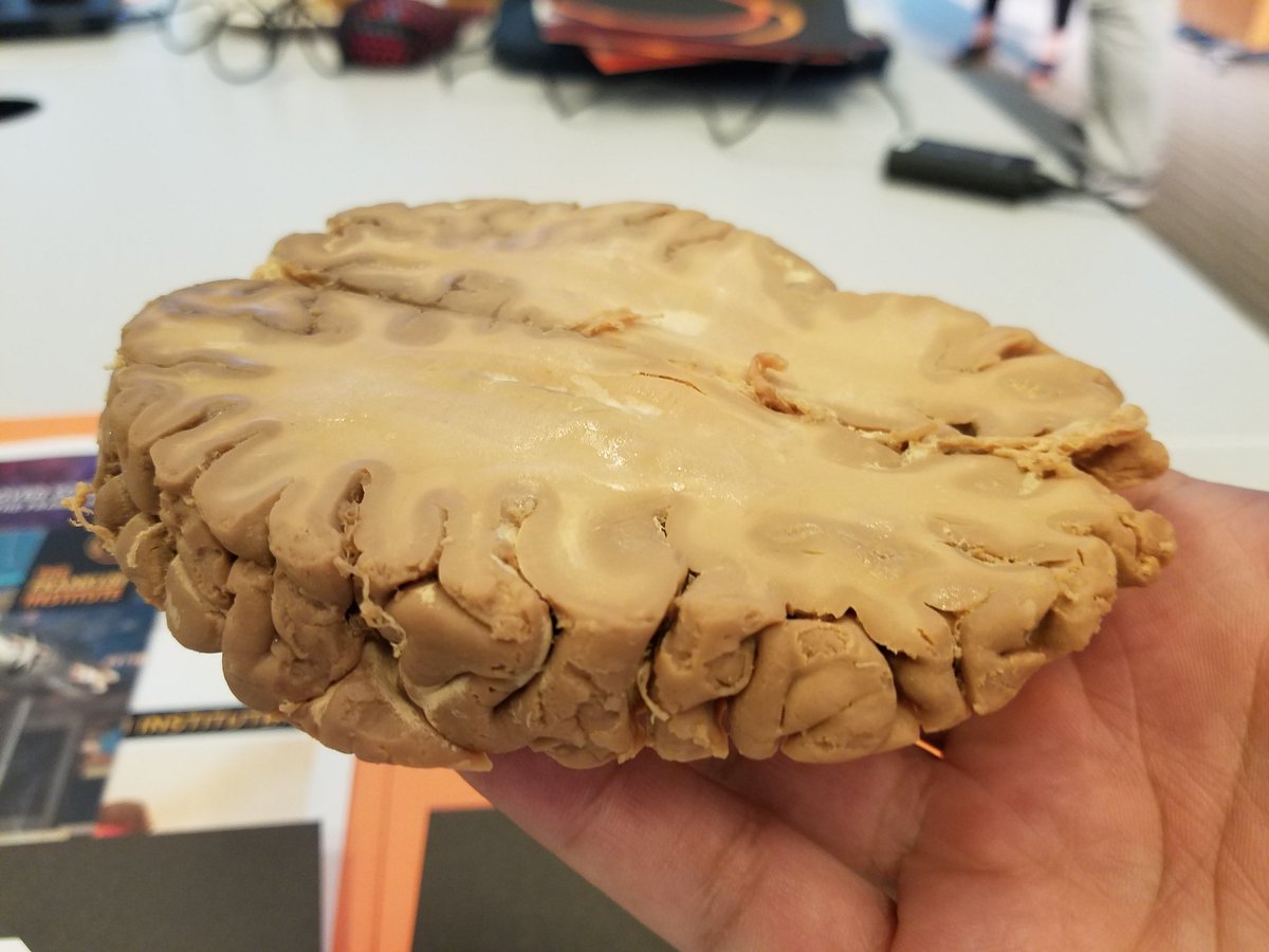 MrAbelRamos's tweet image. West Admin Team curious about the Brain and Learning. #FIbrainPD #westway #learningisactive