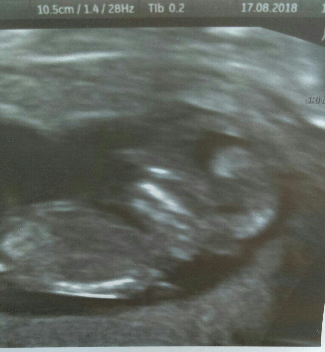 We are so excited to announce we ourselves have a pasty in the oven 😍 #mummytobe <a href="/emmasdiary/">Emma's Diary</a> <a href="/LJsPantry/">LJ's  Pantry</a>