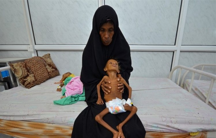 sekerkizkendi86's tweet image. Yaklaşık 2 milyon hacının kurban kestiği Arabistan&apos;ın kapı komşusu Yemen için, BM&apos;ye bağlı UNICEF örgütü her 10 dakikada 5 yaşından küçük bir çocuğun açlıktan hayatını kaybettiğini bildirdi !

#HayırlıBayramlar