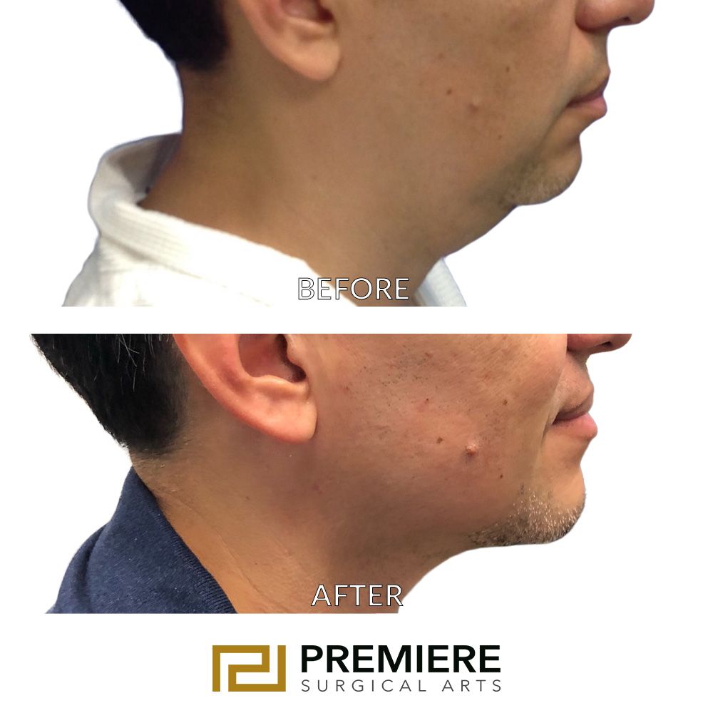 premiere surgical arts texas