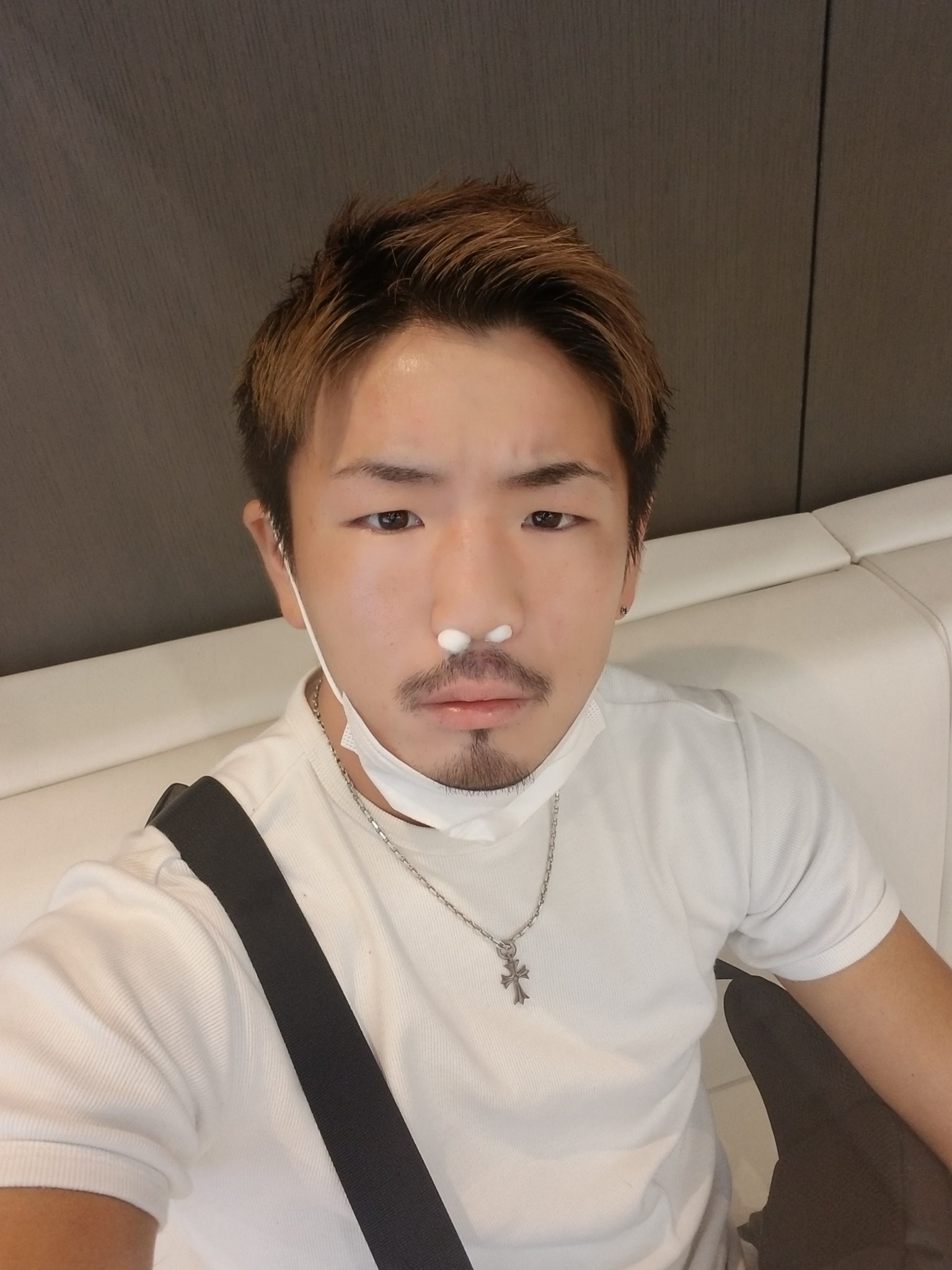 森本狂犬義久 Yoshihisa Morimoto 鼻中隔湾曲症の術後のガーゼ抜き終了 この世の中がこんなに酸素が濃いと思わなかったぜ まじで息した瞬間脳が活性化したのが分かった 痛かったけどまじでやってよかった 森本狂犬義久 Yoshihisa Morimoto 鼻中隔湾曲症の術後のガーゼ抜き終了 この世の中がこんなに酸素が濃いと思わなかったぜ まじで息した瞬間脳が活性化したのが分かった 痛かったけどまじでやってよかった