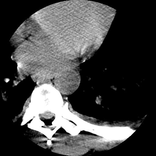 Embodi3D's tweet photo. Are you a #biomedical #3Dprinting guru? Offer your services like #3Dmodelling / scanning / printing service @Embodi3D . https://t.co/fh0PBepSAF #3Dprintablemodel #medicalCTscan #STLFile https://t.co/V4BHfJVqxk