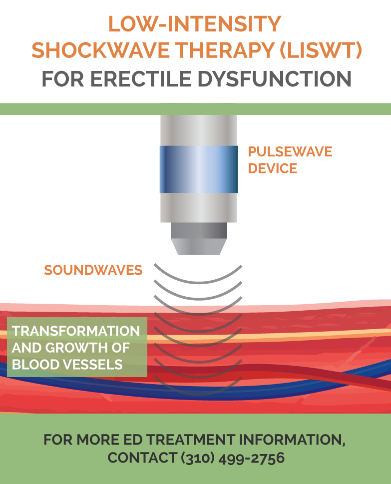 UrologyLA's tweet photo. #LISWT can be used in all men who suffer from #ED or those who do not but simply wish to improve the quality of their erections, increase sexual sensitivity, and possibly promote longer duration of sexual activity. #erectiledysfunction #menshealth https://t.co/aekox078HU