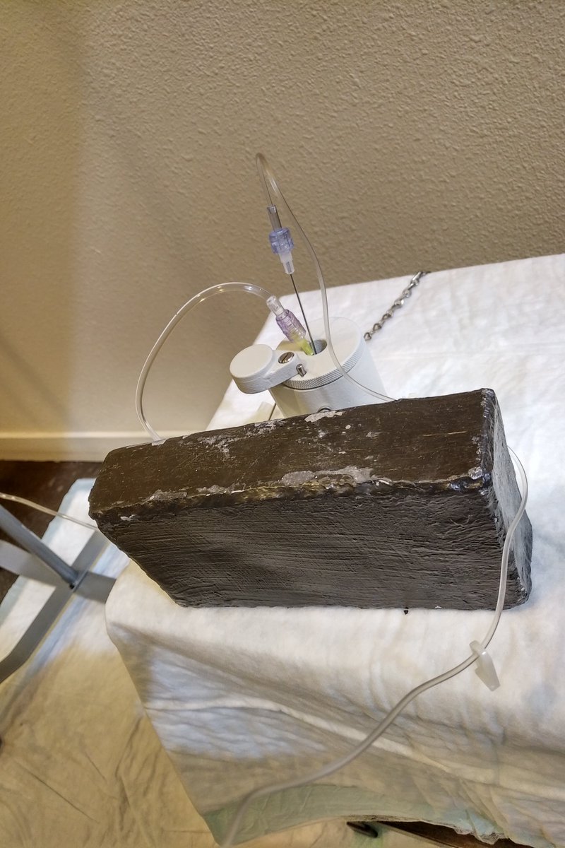 AzJ14e's tweet image. This is what fighting prostate cancer looks like....  a lead shield and a dose of Lutetium 177 (little nuke bomb) being infused...  new treatments on the horizon.... @prostatepedia @ZEROCancer @ProstateOnSite @ThePCRC @MarkScholzMD @advancedpca @ProstateHealing #Fcancer.....