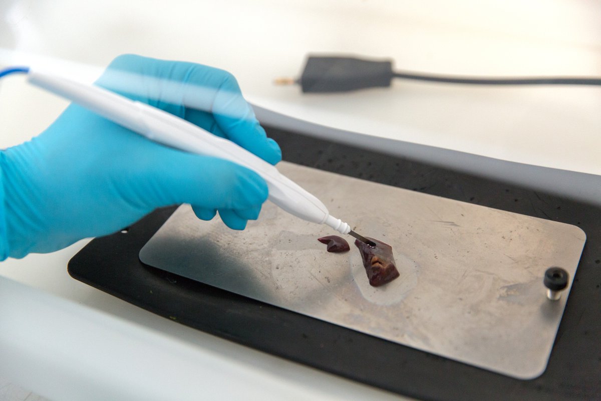 The intelligent knife: A potential 'game-changer' for #cancer surgery - bit.ly/2MhGY9w