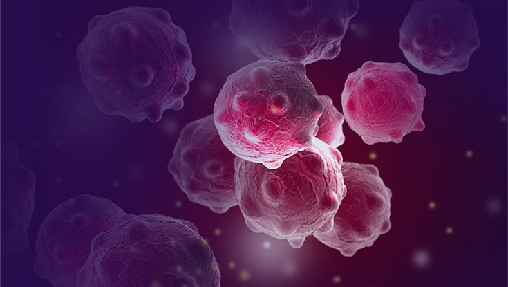uniofgalway's tweet photo. Study Discovers First in World Treatment Strategy to Address Breast Cancer Relapse https://t.co/nEp0mOnV4B https://t.co/qByWoZNWMh
