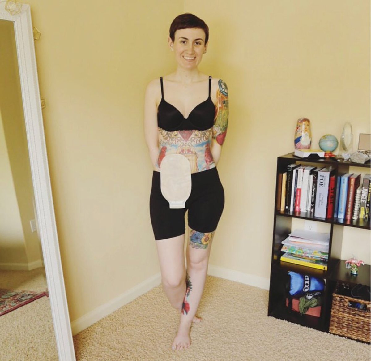 chronicloveclub's tweet photo. #CLCMemberFeature: meet Rachel- a Chron’s warrior who has been through a lot! Check out her story here: https://t.co/pXCcO3IJmY #chronicloveclub #Chrons #ileostomy #surgicalcomplications #spoonie #butyoudontlooksick #incurable #healthcareforall #ostomy #bowelobstruction https://t.co/sN6gWiMNL5