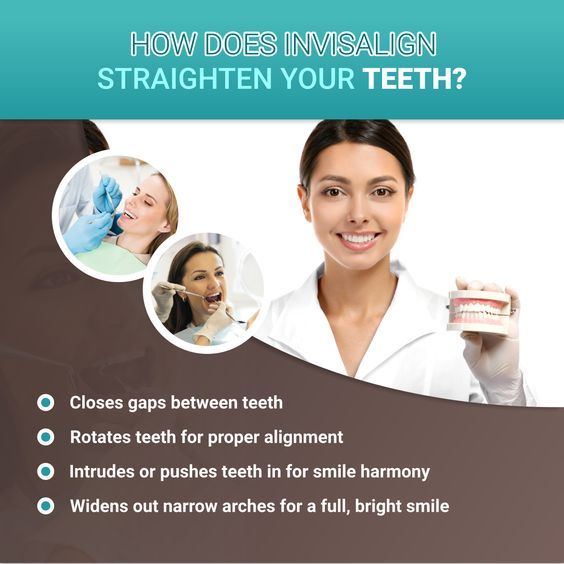 Straighten your teeth without anyone noticing with Invisalign!
Call us now for a free smile consultation on (242) 394-8600 or click to book an appointment buff.ly/2IGkhFF
#StraightTeeth #Invisalign #TreatmentPlan #SmileConsultation #InvisalignProvider #BestDentist