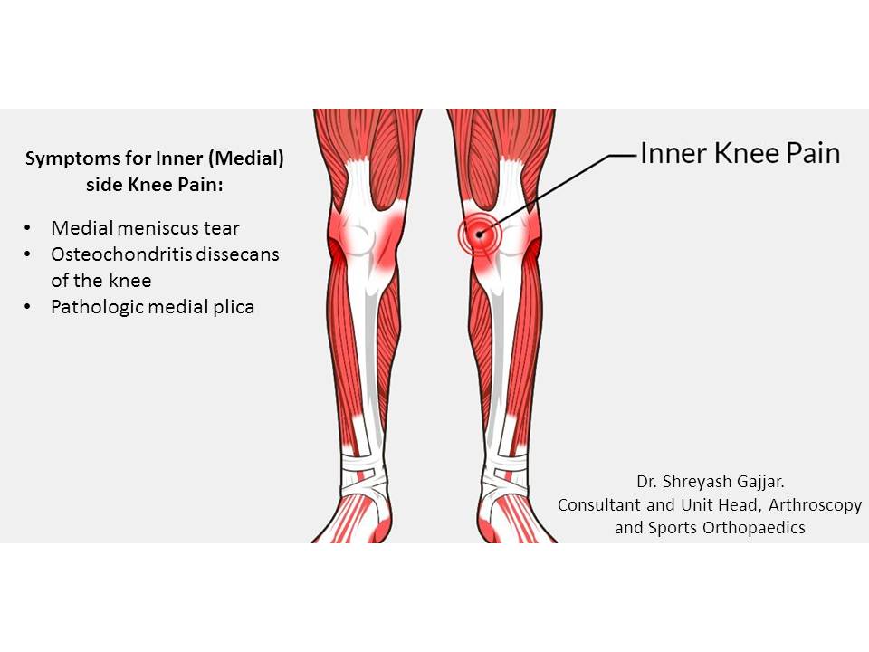 Dr Shreyash M Gajjar On Twitter Causes Of Knee Pain In