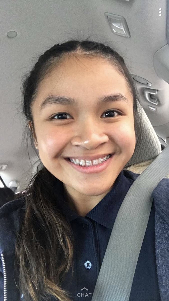 _janellebalecha's tweet photo. BROOOO my bestfriend @SoberanoMaeyah just got braces and bro she looks so beautiful 🤧🤧😭 i cant 💀 https://t.co/tJA8QFVOCS