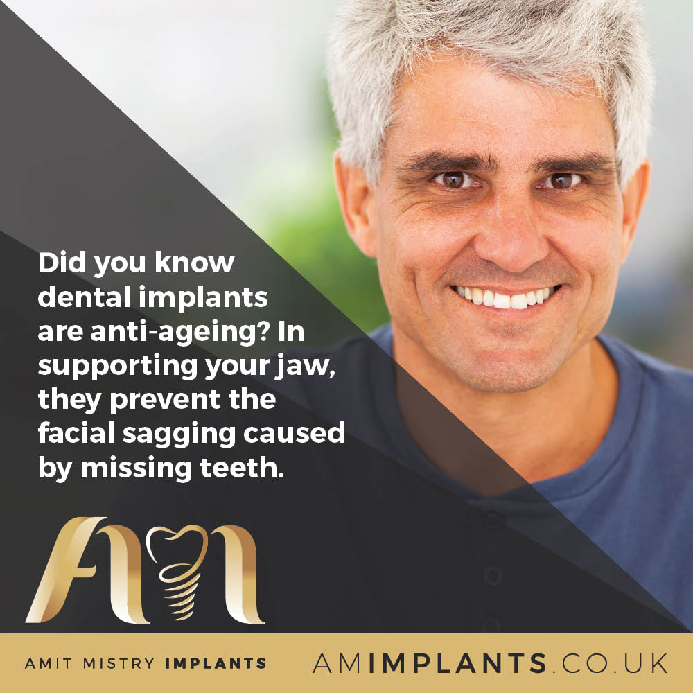 AMImplants's tweet image. Take action on your smile with permanent dental implants – book a consultation with Amit today! amimplants.co.uk #dentalimplants #teethinaday! #dental #implants #allonfour #dentalimplantsurgeon