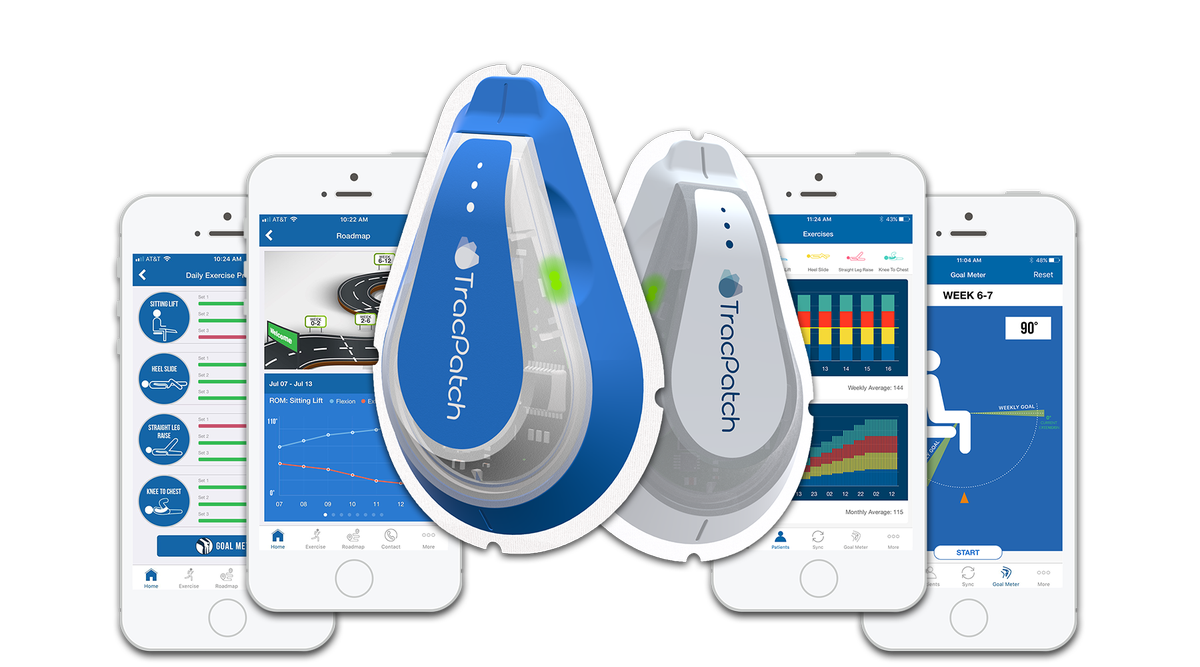 ConsensusOrtho's tweet photo. The Medical Wearable Device Market continues to grow! Read more here: https://t.co/C5lT3nkPRA
TracPatch is here for your orthopedic wearable needs.
https://t.co/mgpHUvaWNQ #TracMyMoves #MakinTracs #TracPatch #WearableTechnology #BigData #EvidenceBasedMedicine https://t.co/aqHXxxYanU