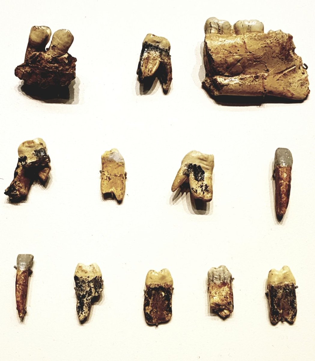 #FossilFriday Teeth and mandible fragments composing Hominid 1 of Homo antecessor, found in Gran Dolina, #Atapuerca. Dated c. 800 ka.