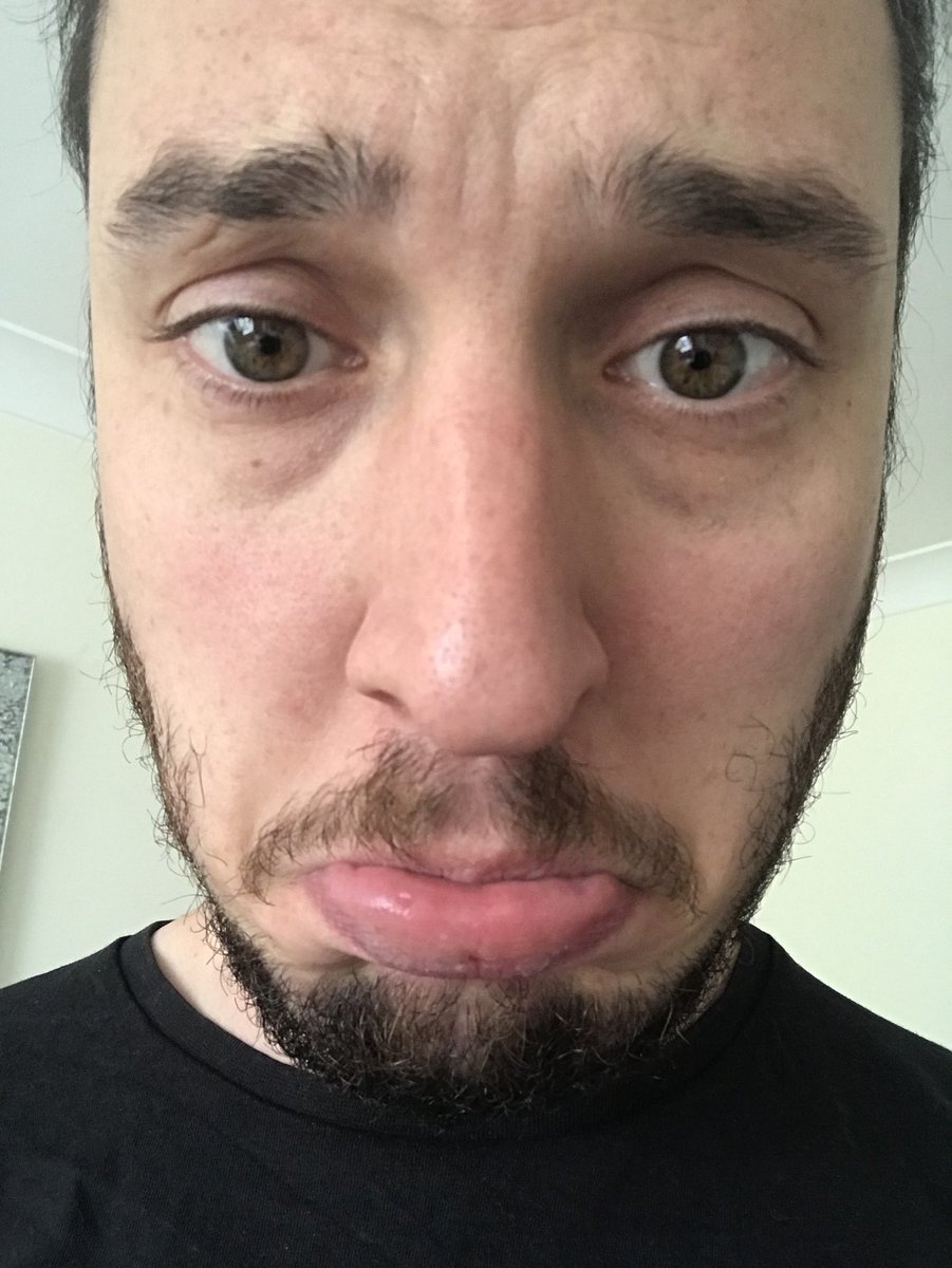 IanSimpsonPoker's tweet photo. Sorry everyone due to technical difficulties I can’t stream :-( #sadbeans https://t.co/41LmlqAx4N