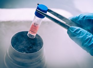 MedicalBriefZA's tweet photo. SA’s #stemcells industry: Preying on the gullible, facilitated by med schemes - @AlastairMcA30 writes for MB.
#digitalclubbing
https://t.co/AlwHtY1fkz https://t.co/fPifvgdrGp