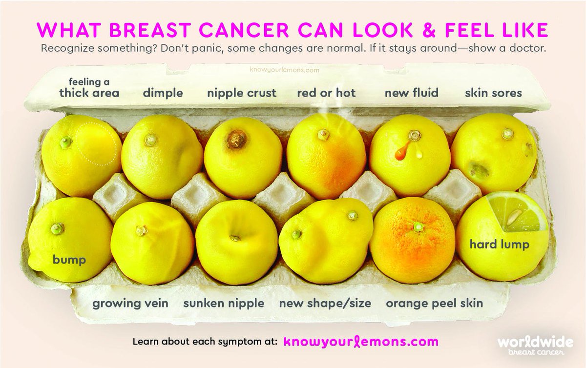 AMA_Marketing's tweet photo. After 14 years of work, the #KnowYourLemons campaign went viral and was seen by 166 million people in three weeks. Here's how @knowyourlemons did it: https://t.co/SU3k2E0HRe https://t.co/3nVmzLsvSi