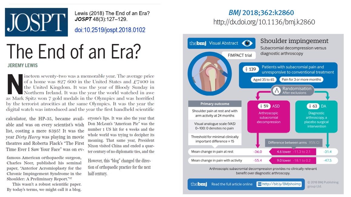 More evidence for the "End of an Era" for Subacromial Impingement and Acromial Decompression?
jospt.org/doi/10.2519/jo…

The FIMPACT study: bmjopen.bmj.com/content/7/5/e0…