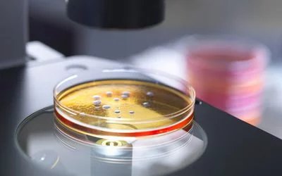 Medibio11's tweet photo. Isolation and Characterization of Starter Culture Bacteria for Ensete Ventricosum Fermentation.
To know more follow the path: https://t.co/EOYxo1eQnE
Email: biomed@scitechnol.com https://t.co/fFChUue7Uv