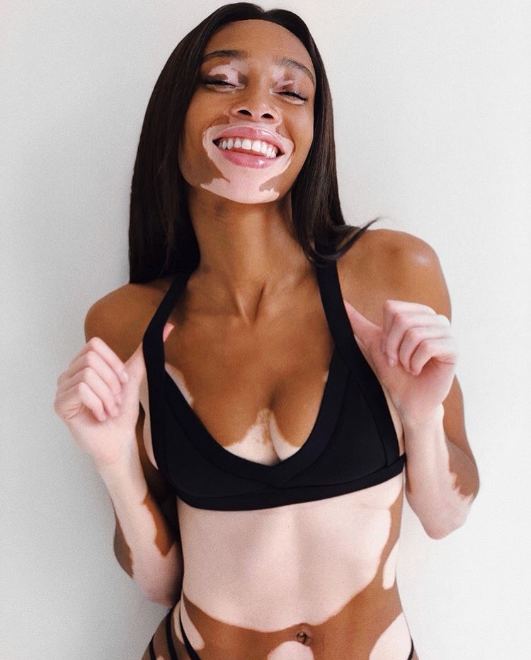 Smiling like <a href="/winnieharlow/">♔Winnie Harlow♔</a> because it’s bank holiday weekend 😄⠀⠀