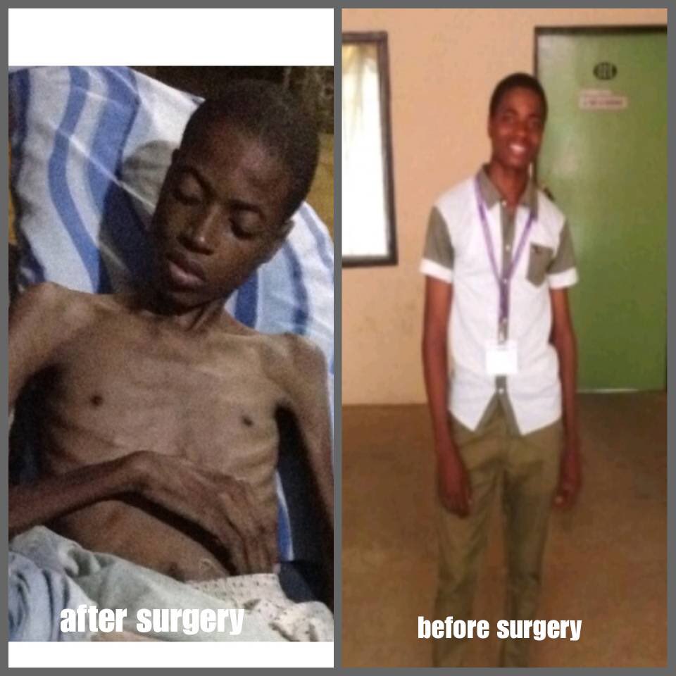 highfly85100209's tweet photo. Hello guys I'm here again on behalf of a friend a brother😔... this is Oderinde Victory my high school classmate. One of the smartest in the class, always happy and with the perfect smile to cheer you up whenever you're down 
Please help retweet😔 let's help victory https://t.co/QGYfjlfkAA