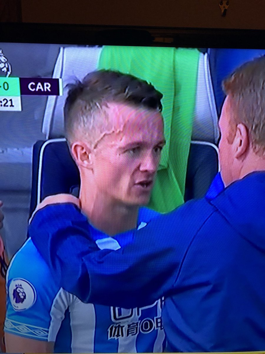 Jonathan Hogg’s forehead looks like a relief map of the Himalayas