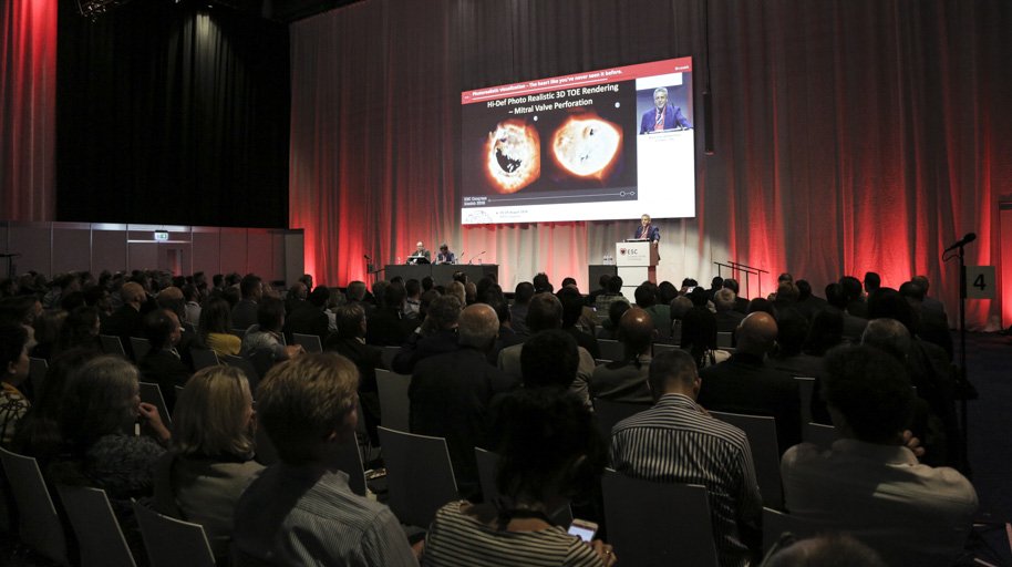 PhilipsLiveFrom's tweet image. The highlight of our day was the 'Witness a big leap in patient care thanks to Echo' symposium. How about you, what takes the trophey for day 2 at #ESCCongress?