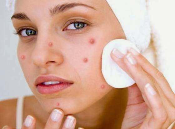 debbiesa47's tweet image. 10 ways to remove pimples from your face before going Back to School 2018 &amp;gt;&amp;gt;goo.gl/ct8k2S #Back to School 2018