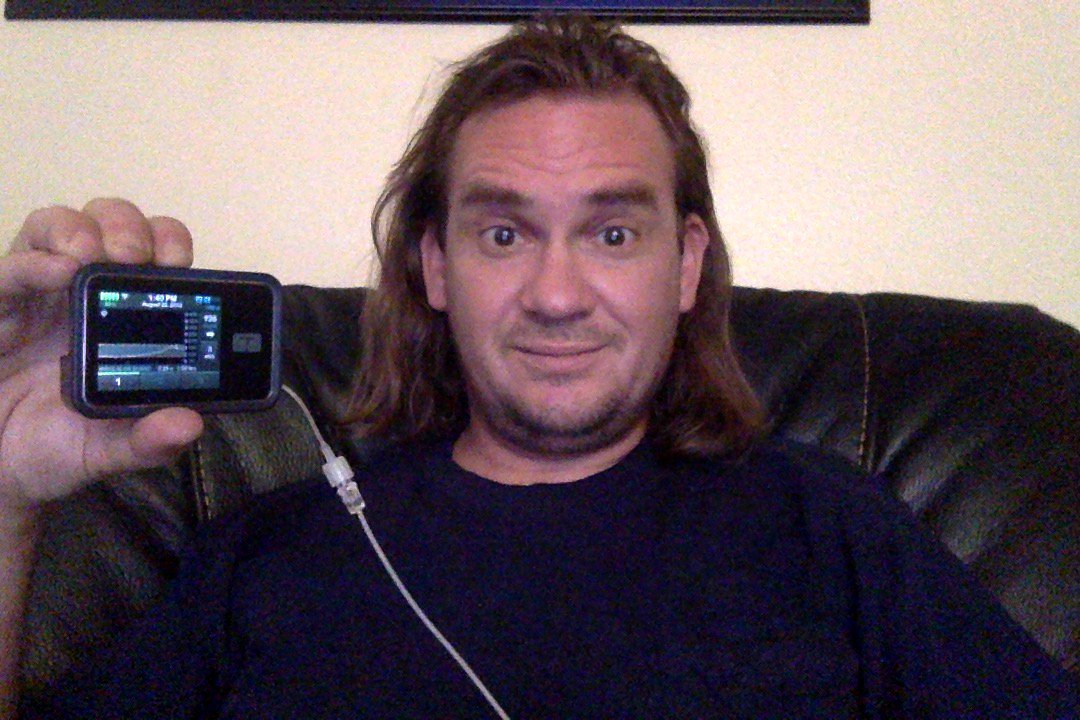 gwsuperfan's tweet image. Up and running with my @TandemDiabetes #TslimX2 and the #BasalIQ update! #T1D