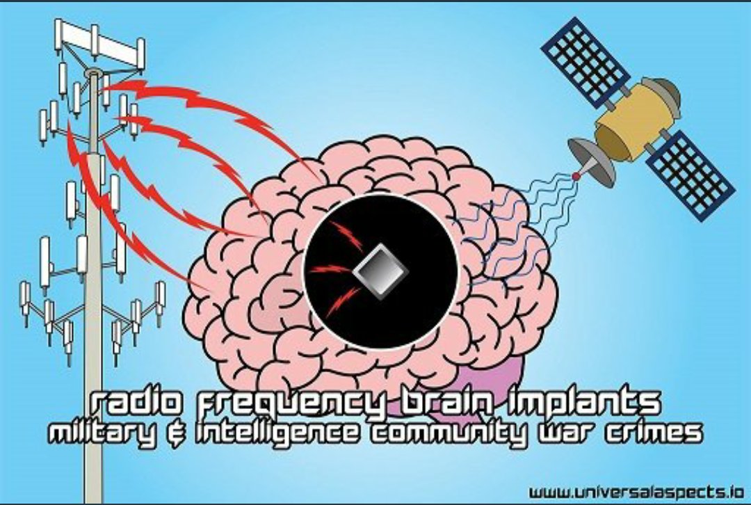 Tuyo On Twitter 遠隔から電磁波照射 頭部圧迫 眼球圧迫 眼球がパンパンに 苦しすぎる テクノロジー犯罪