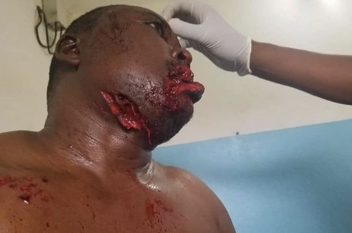 BbiHarfoSi's tweet photo. Time #WhenNoOneIsLooking has PASSED #WasntExpecting that? @antonioguterres #IWantToBeRememberedAs exposing FAKE worldsystem.. STOP #GenocideInSouthernCameroons uphold #UnRes1608 @UNPeacekeeping @UN @SwedenUN @KarenPierceUN @theresa_may @EmmanuelMacron @Europarl_EN @FinlandUN @hrw https://t.co/rMweJH2sXT