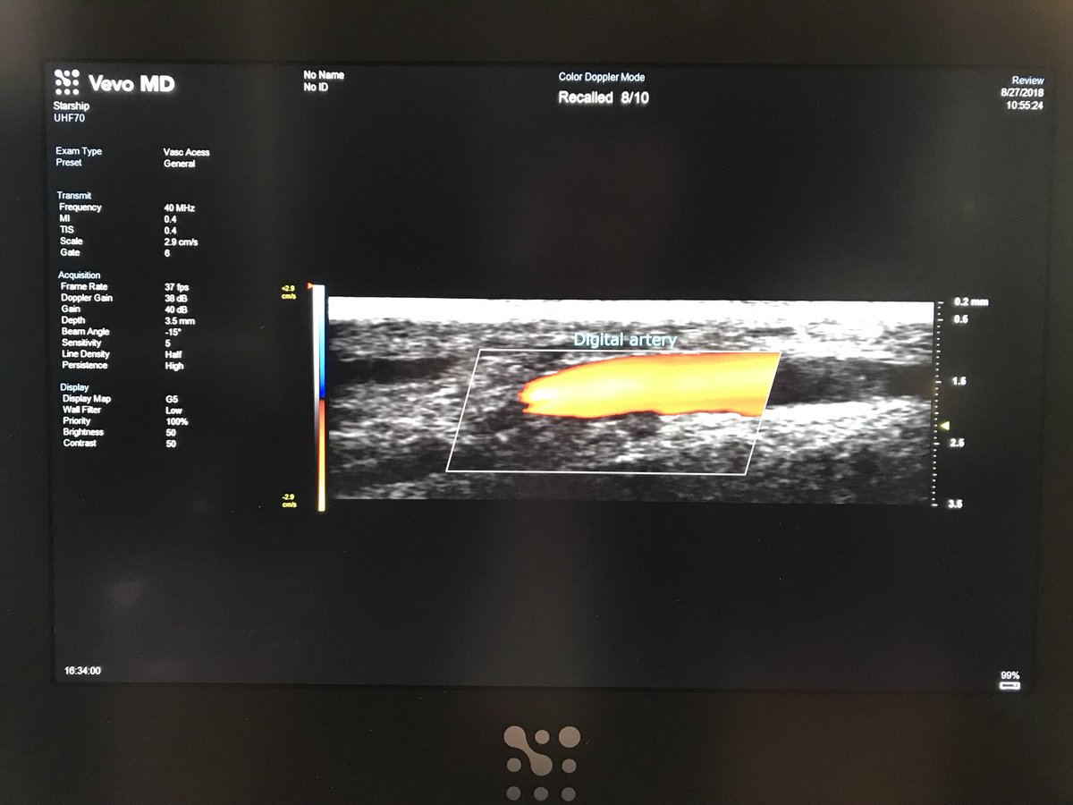 sonosite_anz's tweet photo. You can see what?! Come to the SonoSite booth and experience the joys of ultra high frequency ultrasound scanning! #SonoSiteDFTB #DFTB18 https://t.co/0ukjrtdQfu