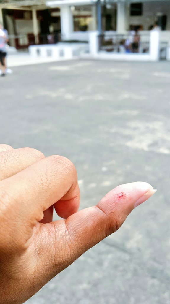 litolnav's tweet image. alam niyo ba &apos;yong masusugatan ka out of nowhere? hindi mo talaga alam kung kailan, saan, paano ka nasugatan. tapos hindi naman masakit sa una kasi hindi mo ramdam pero noong nakita mo na, atsaka pa lang sasakit. #SKLkolang