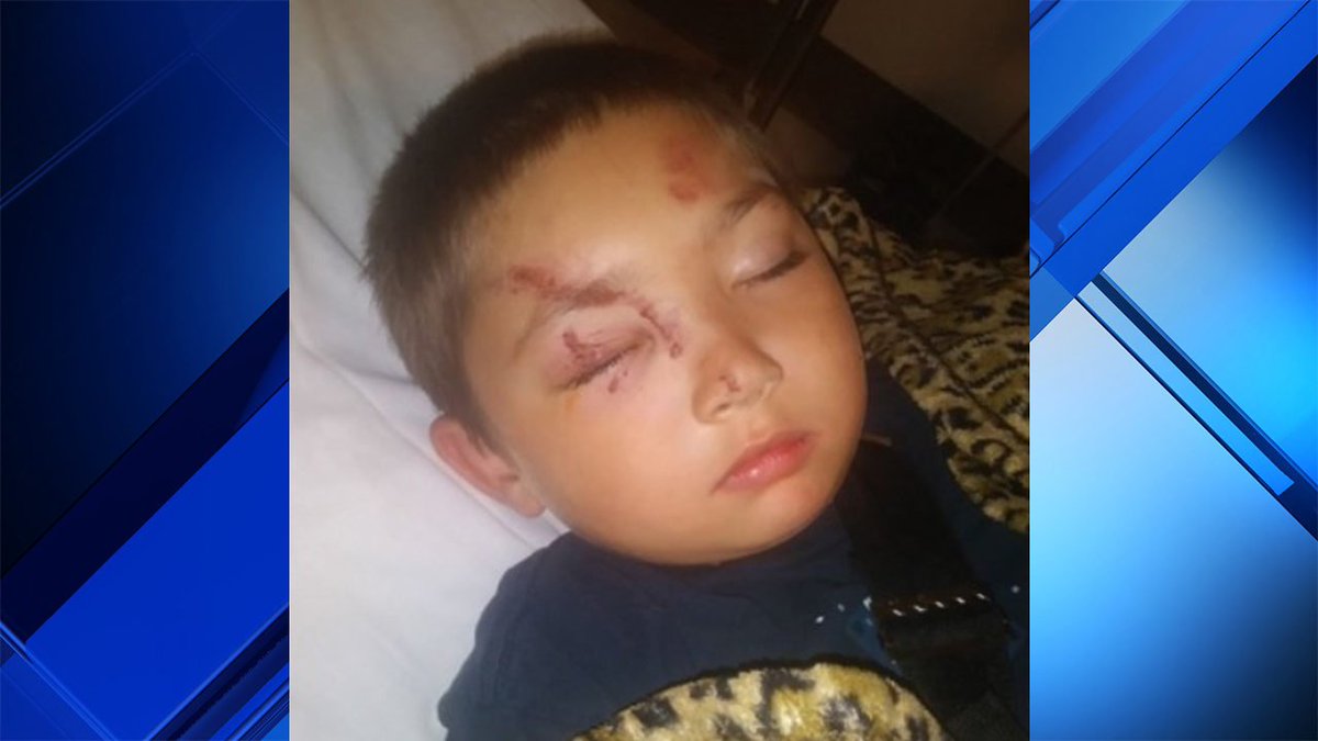 6-year-old boy beaten up while trying to protect friend from bullies. bit.ly/2P9LfbP?utm_so… https://t.co/fEn0a2vbzG