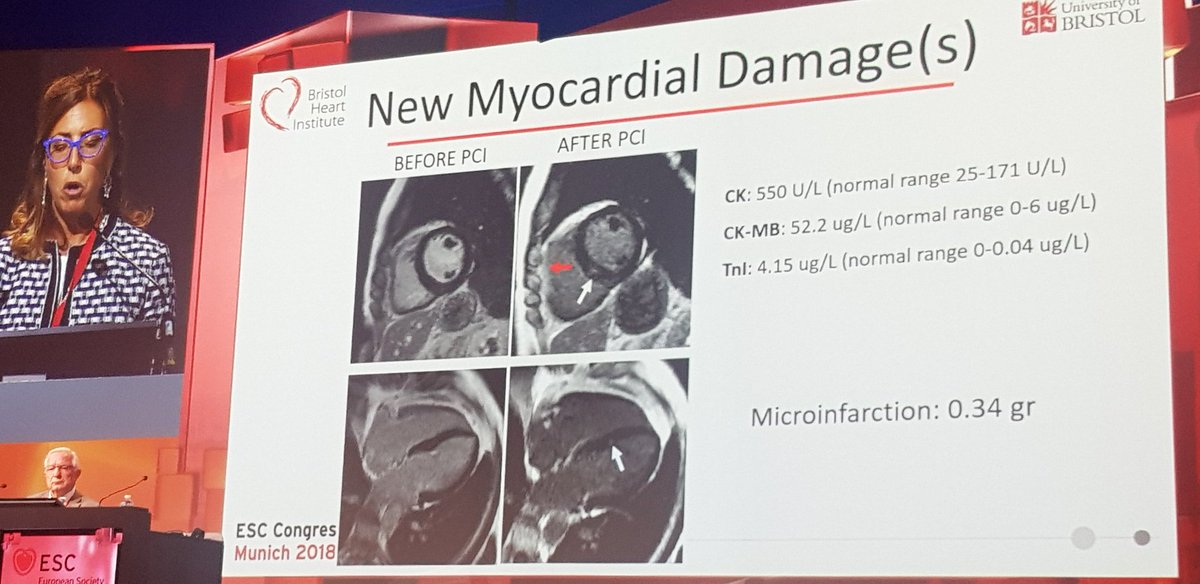 European Society of Cardiology tweet media