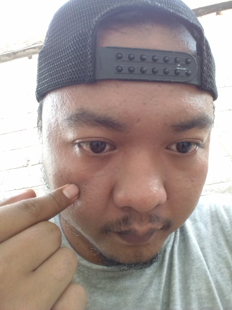 armando_oi's tweet photo. Jangan di pencet,itu sakit 😆😆😆 https://t.co/ZAPH0NIIUz