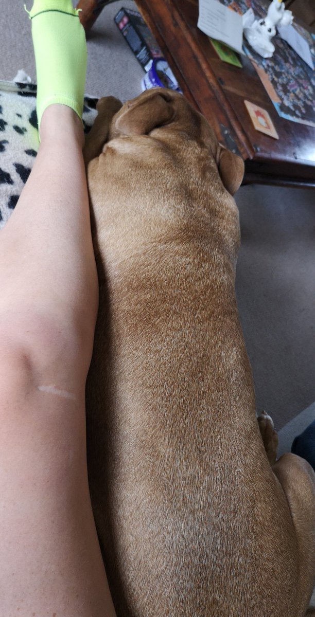 salvaughan's tweet photo. Aww Pheebs - think she realises how bad my leg is...so gentle with her cuddles
#rescuedog #rescue #DogsofTwittter #staffie #staffy #staffiecross #mixedbread https://t.co/kv46paH1W2
