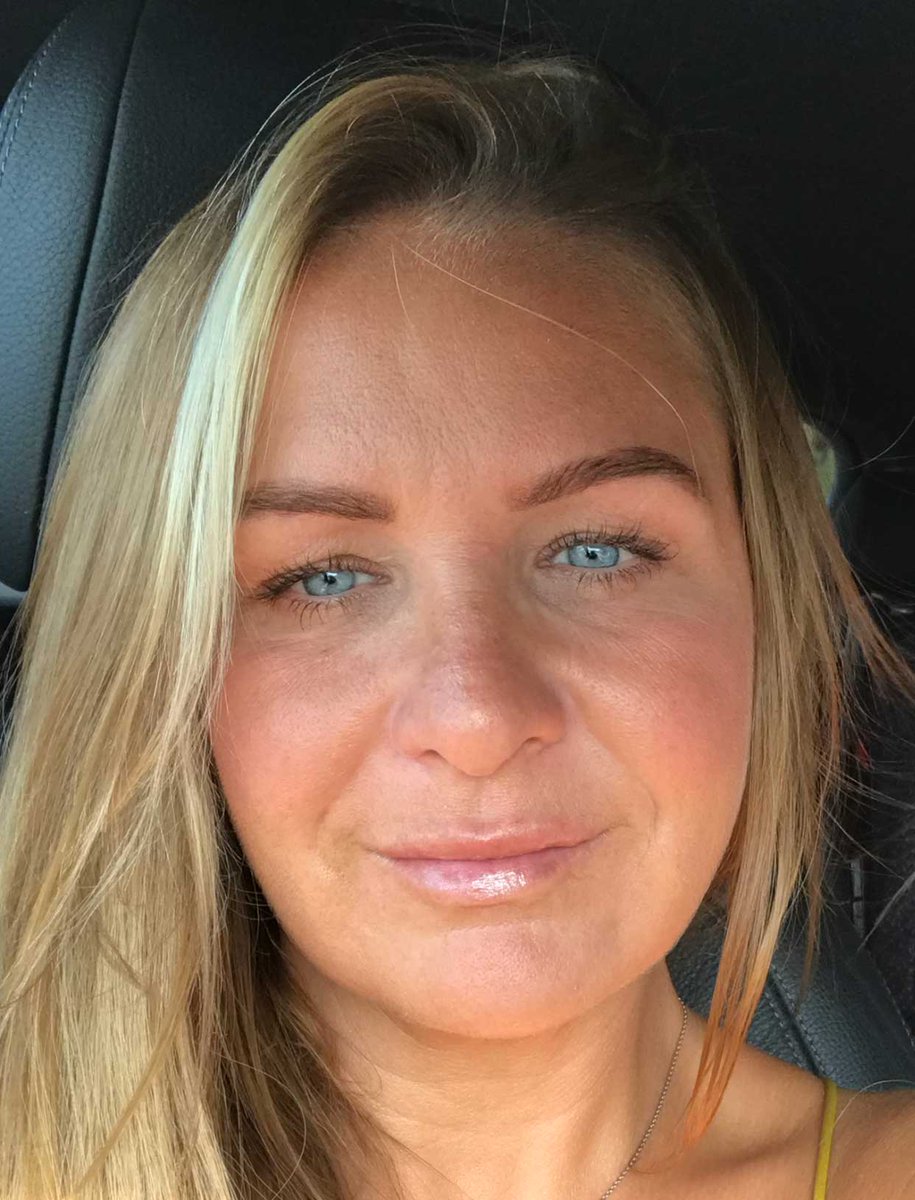 Rejuven_uk's tweet photo. My Skin Needling Journey | Follow Louise, our newest team member, over the next 6 weeks as she has Skin Needling (CST) treatments and see how it changes her skin. Full details over on the website #skinneedling #cit #skincare #skin https://t.co/54Q9M0mvuQ https://t.co/TpLIcN6pQv