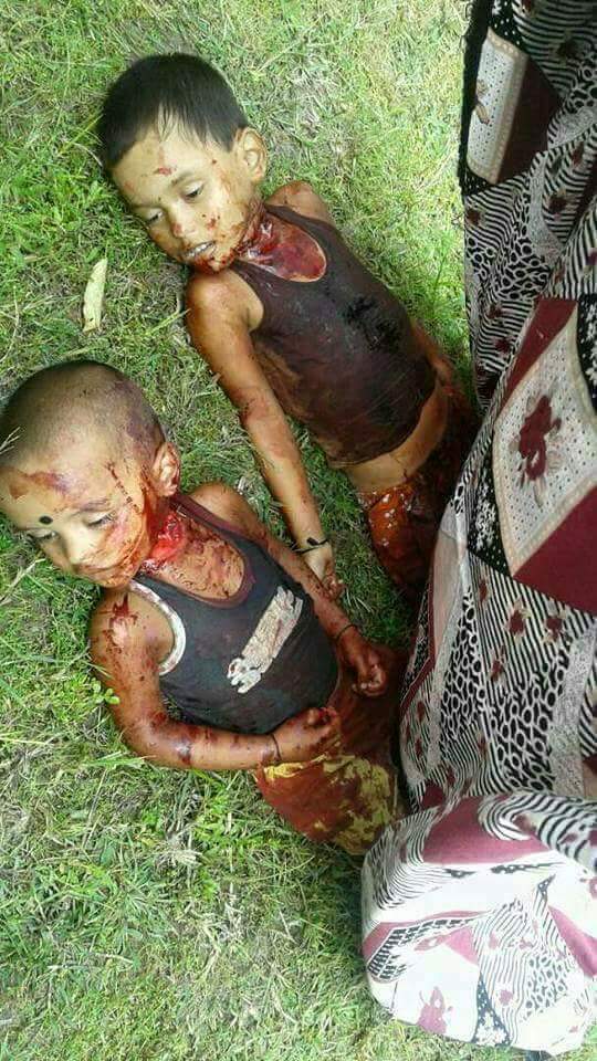 .ယုတ္မာရက္စက္ေသာဘဂၤါလီကလားဆိုး၏လုပ္ရပ္
Look at !

Completely typical ethnic Rakhine feature.

Two innocent kids brutally and inhumanly killed 

by barbaric Bingalis.

Those of extremist terrorists been reportedly 

suported by some of UN agencies.

World is still in silence !