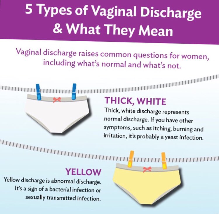 Wunmiomololu On Twitter Vaginal Discharge Is A Regular