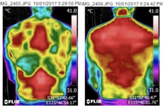 acupuncturecbd's tweet photo. DNA (Distal Needling Acupuncture) - Thermal Imaging: DNA ultimately increases and restores blood flow to the affected areas of the body to promote the healing process. https://t.co/oU2jAJoXzl https://t.co/zpAVzMdjpQ