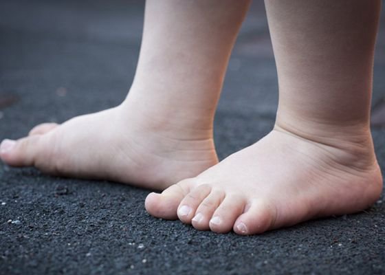 TheBiomechLab's tweet image. Should you be concerned about your child having flat feet? I believe not.

Click the link below to read more. 
buff.ly/2MQh6AN 

#paediatricdevelopment #clinicalexcellence #thetbldifference
