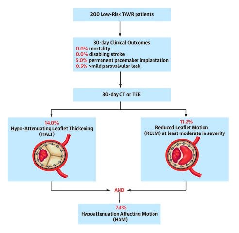 JACCJournals's tweet photo. First randomized trial of #TAVR in low-risk symptomatic severe #aorticstenosis shows low procedural complication rates, short hospital stay, no mortality, &amp; no disabling stroke at 30 days. Full study in #JACC: https://t.co/sVhWNNMem4 @ronwaksman  @CRT_meeting  #ESCCongress LBCT https://t.co/K1WD6z3GRq