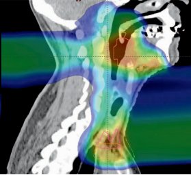 ebook ct scan a medical