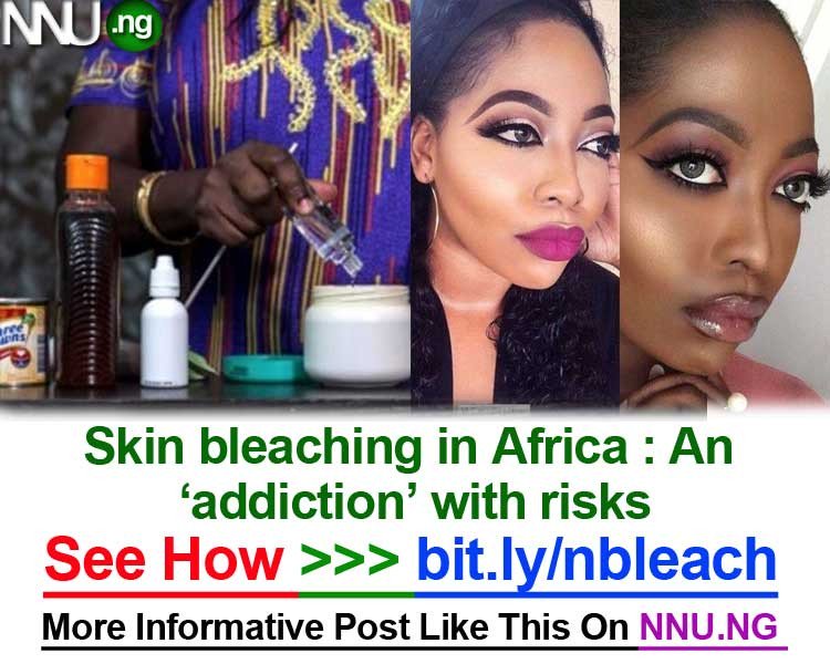 TEMITORPZEE's tweet photo. #NNU_Income - Skin bleaching in Africa : An ‘addiction’ with risks - See How >>> https://t.co/bz7YcM2wqM https://t.co/9bvAENTObF