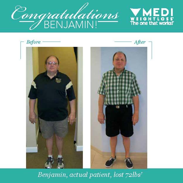 MediHuntersvill's tweet photo. Benjamin lost 72 pounds with the help of Medi-Weightloss. Congratulations, Benjamin! #TransformationTuesday #TheOneThatWorks #MediWeightlos https://t.co/e1LFkoNr5Q