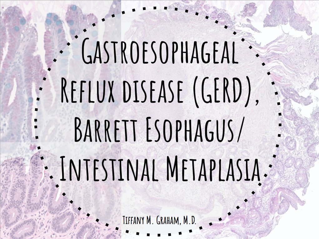 HeartPathology's tweet photo. Transitioning to the GI world. High yield review of Barrett esophagus.
See the full post at link below
https://t.co/LKX20DFshG
#PathTweetAward #IHeartPathology #GIPath #PathforResidents https://t.co/j3qAPR3FDo